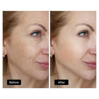 Derm Rays LED Light Therapy Mask for Face, Neck and Decolletage