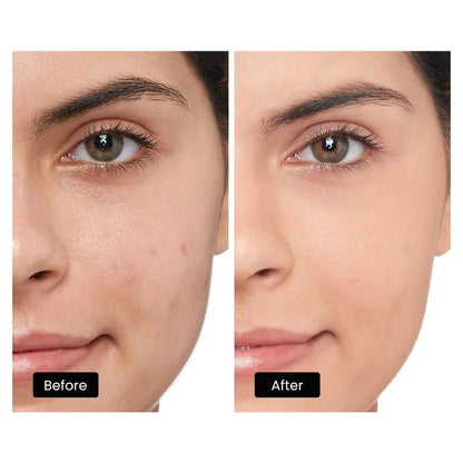 Derm Rays LED Light Therapy Mask for Face, Neck and Decolletage