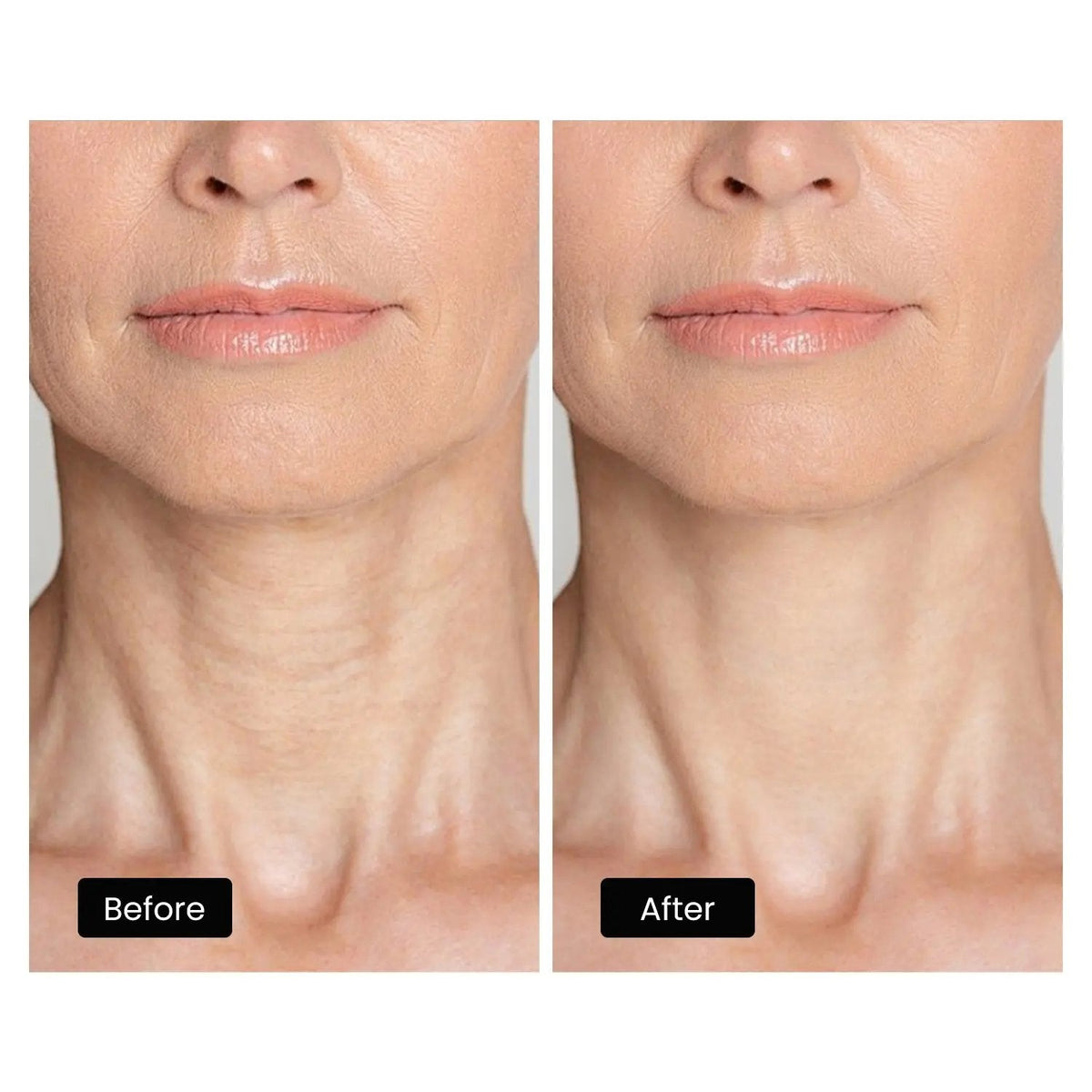 Derm Rays LED Light Therapy Mask for Face, Neck and Decolletage