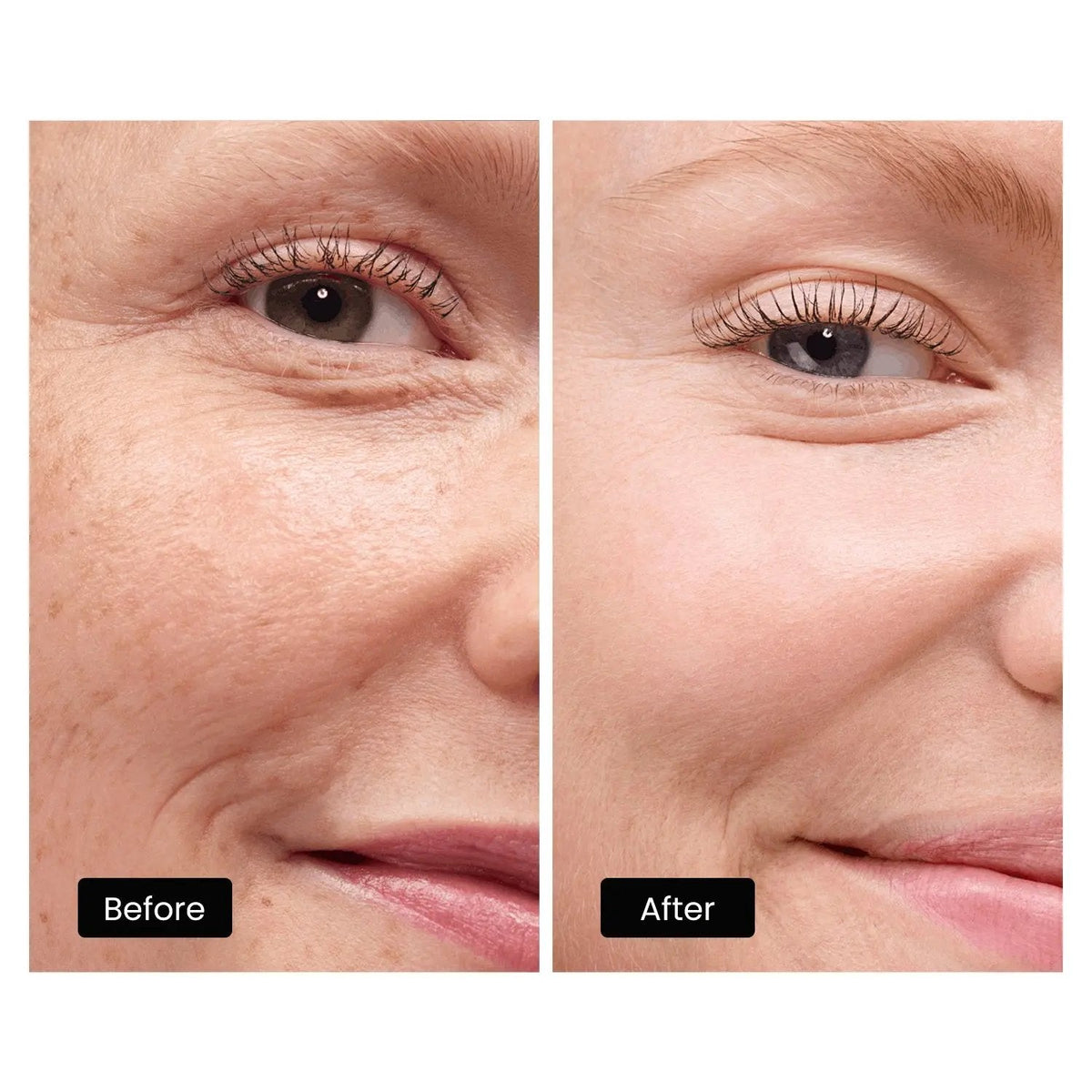 Derm Rays LED Light Therapy Mask for Face, Neck and Decolletage
