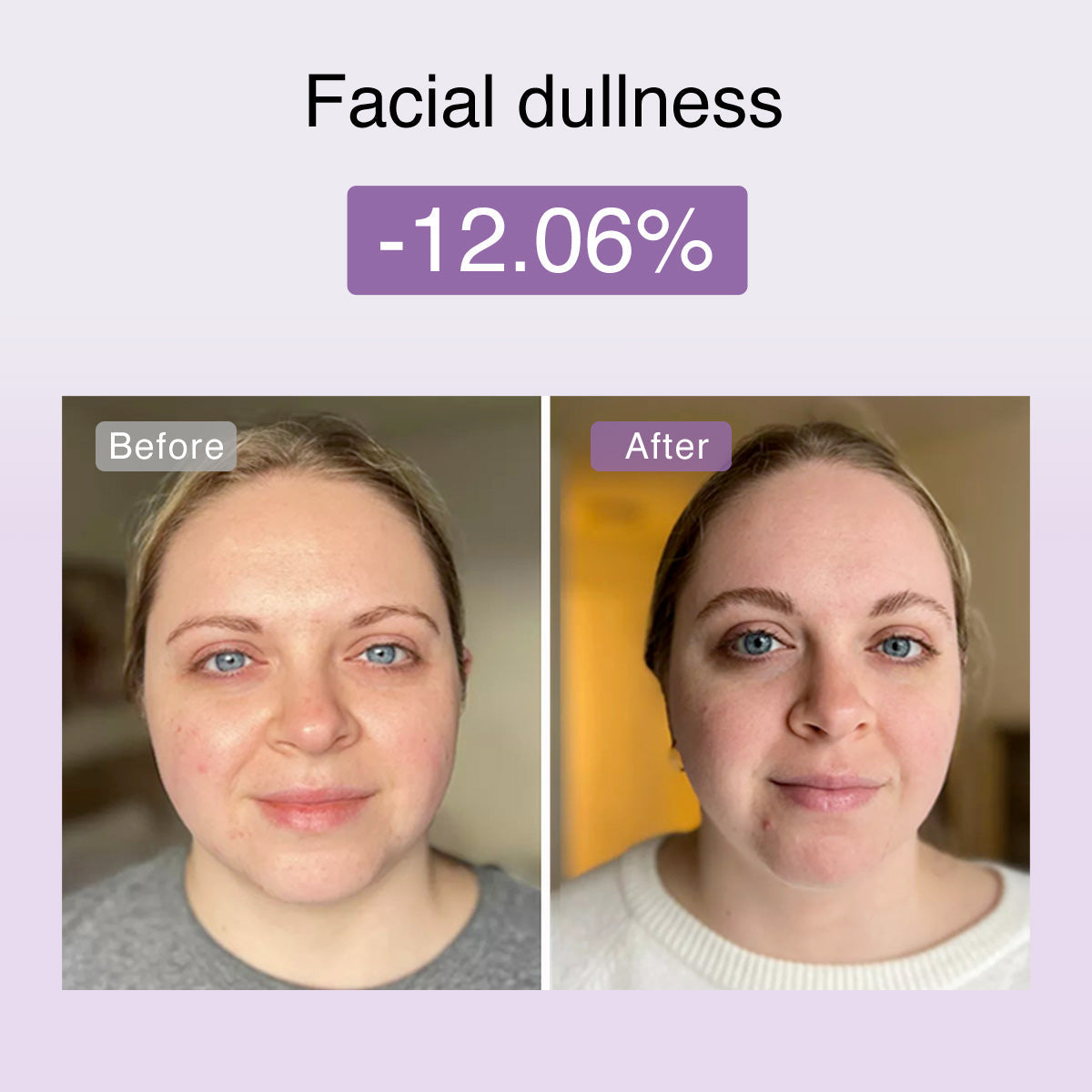 Derm Rays FusionGlow Microcurrent Facial Toning Device