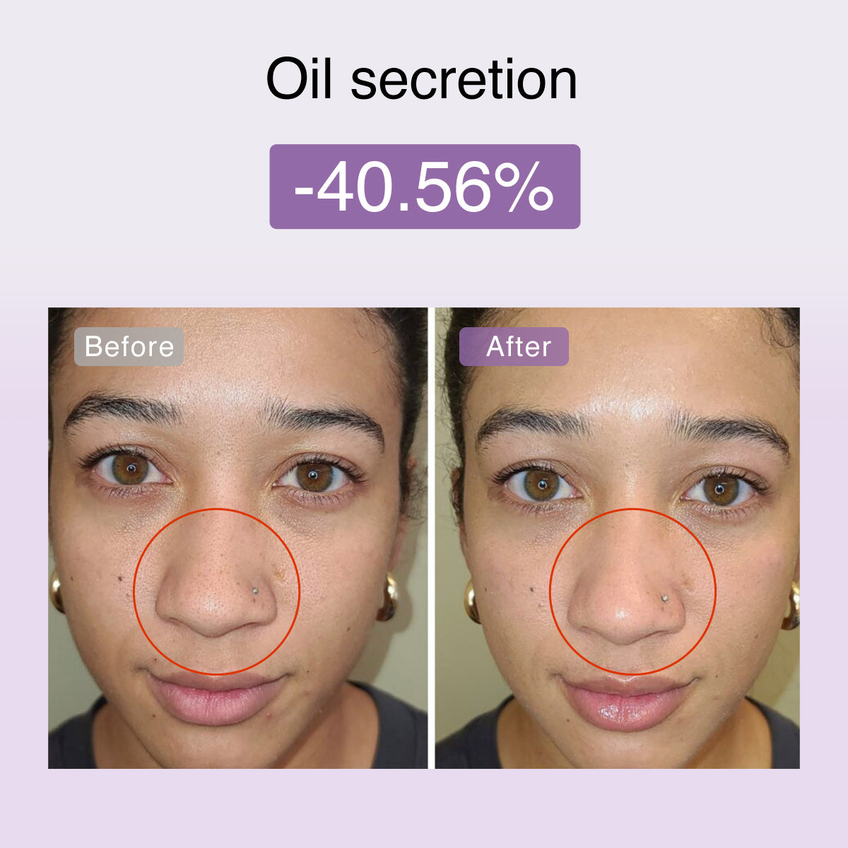 Derm Rays FusionGlow Microcurrent Facial Toning Device
