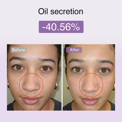 Derm Rays FusionGlow Microcurrent Facial Toning Device