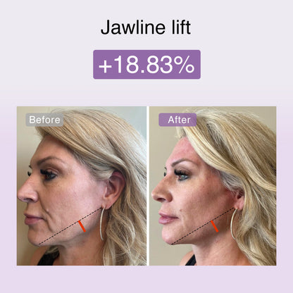 Derm Rays FusionGlow Microcurrent Facial Toning Device