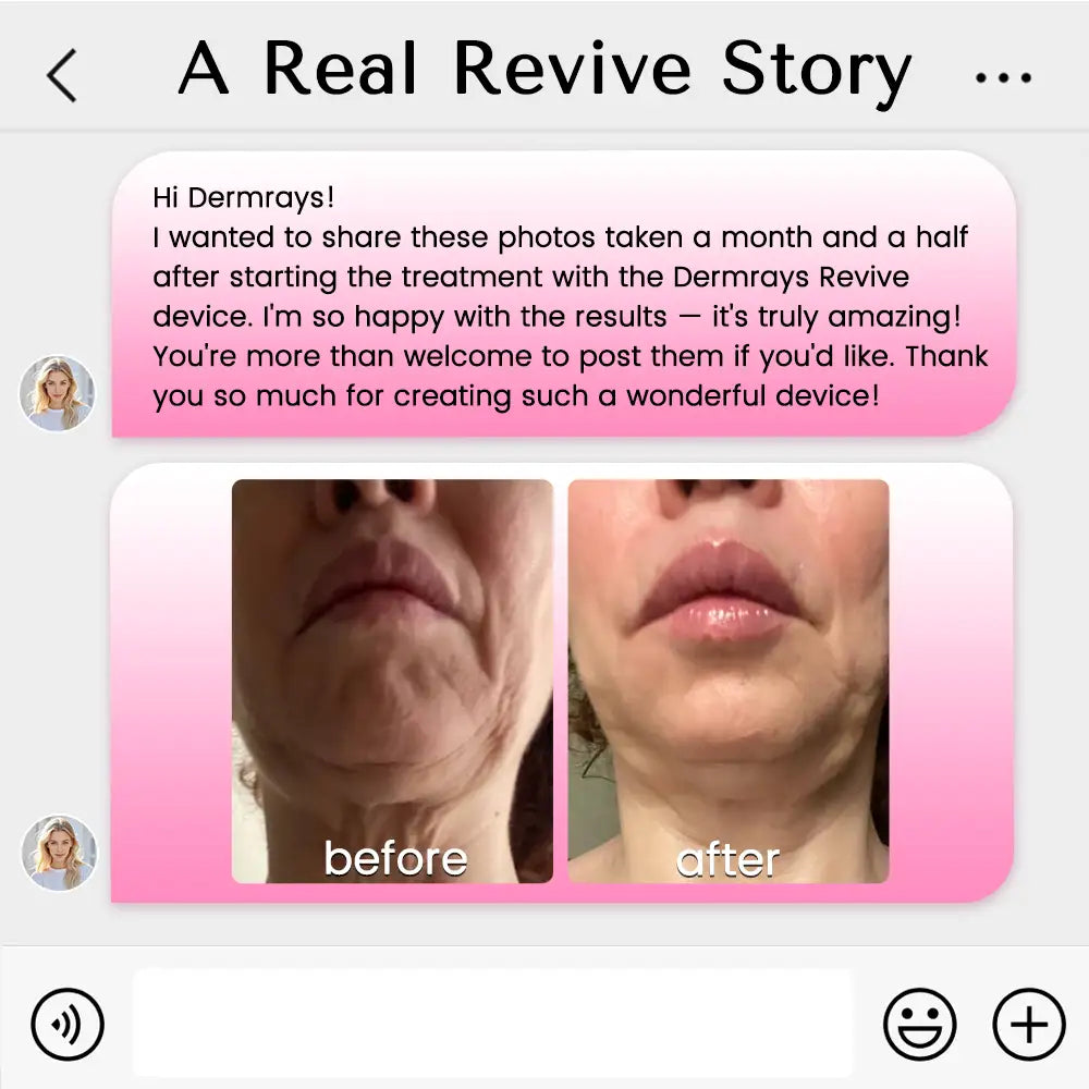 Derm Rays Revive 1064nm Skincare Laser Device